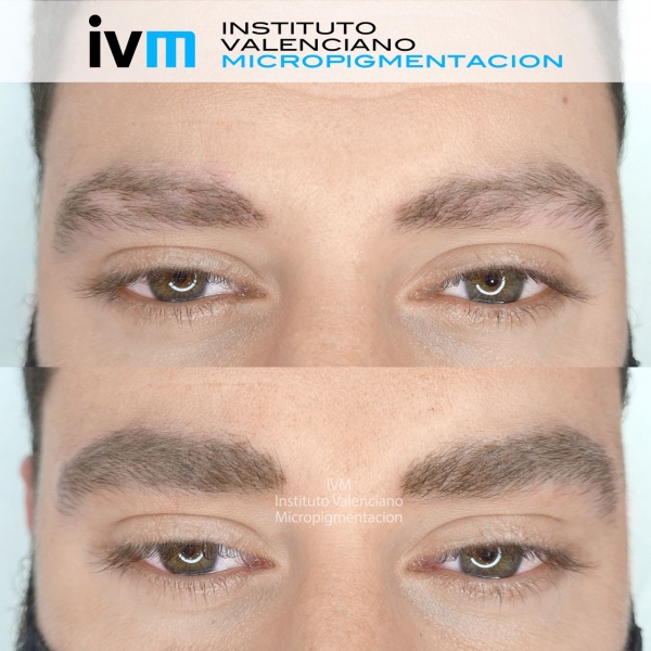 MICROPIGMENTACION_CEJA_MASCULINA