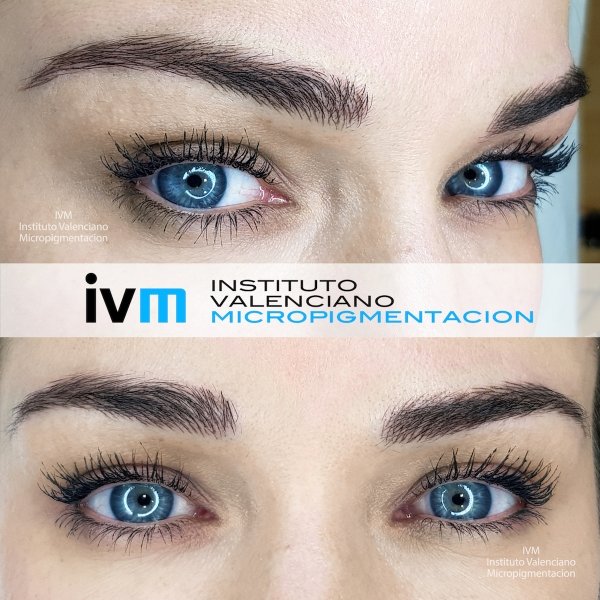 MICROPIGMENTACION-CEJAS-IVM