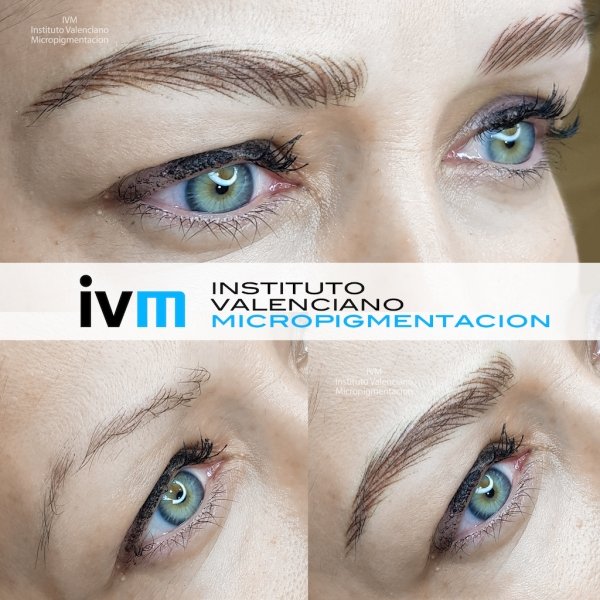 MICROPIGMENTACION-CEJAS-IVM