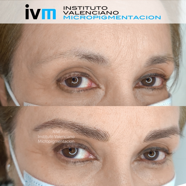 MICROPIGMENTACION-CEJAS-IVM