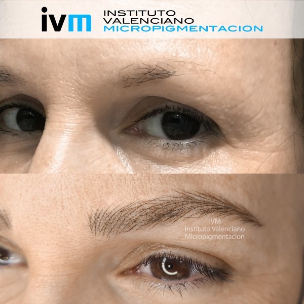 MICROPIGMENTACION-CEJAS-IVM