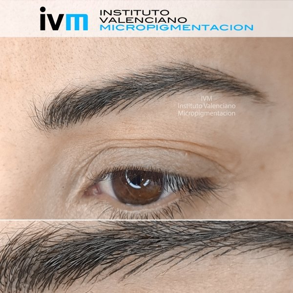 MICROPIGMENTACION-CEJAS-IVM