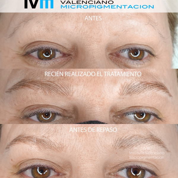 MICROPIGMENTACION-CEJAS-IVM