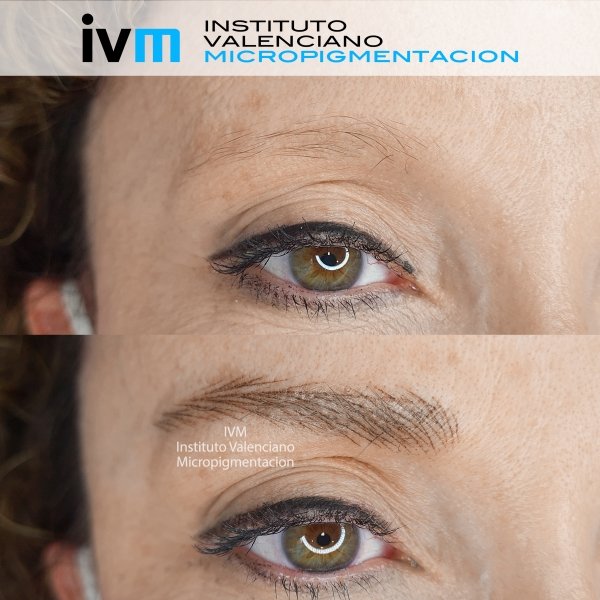 MICROPIGMENTACION-CEJAS-IVM