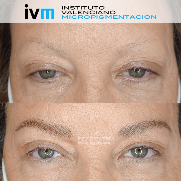 MICROPIGMENTACION-CEJAS-IVM