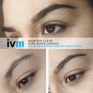 MICROPIGMENTACION-CEJAS-IVM