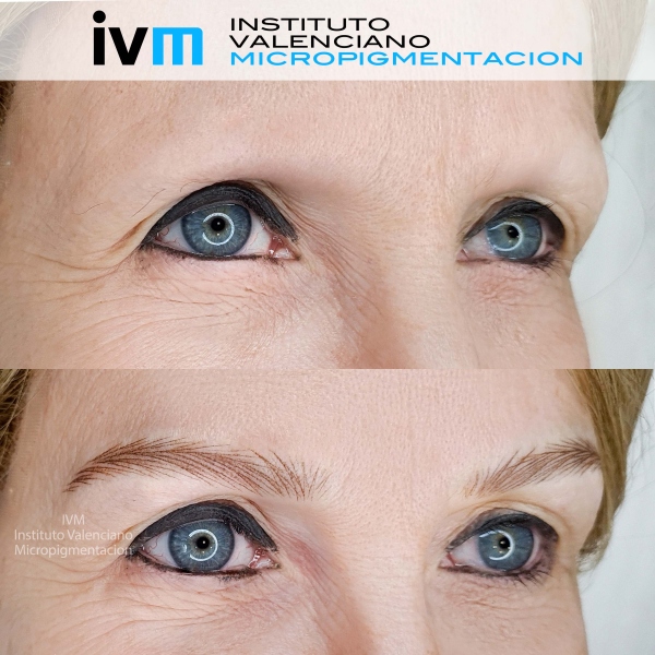 MICROPIGMENTACION-CEJAS-IVM