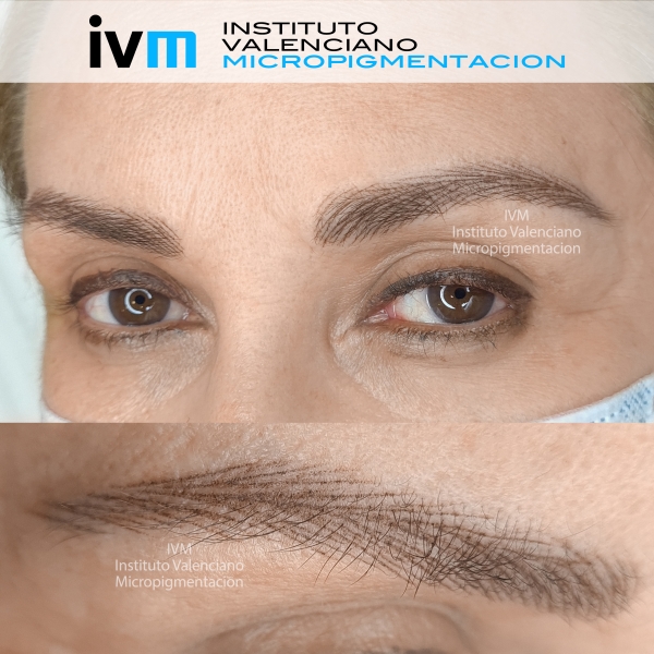 MICROPIGMENTACION-CEJAS-IVM