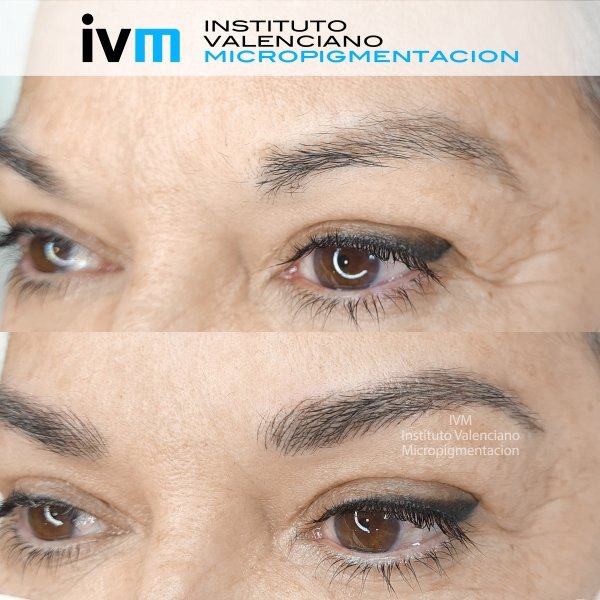 MICROPIGMENTACION-CEJAS-IVM