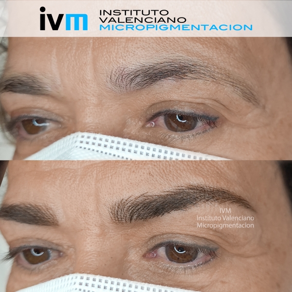 MICROPIGMENTACION-CEJAS-IVM