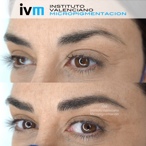 MICROPIGMENTACION-CEJAS-IVM