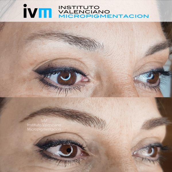 MICROPIGMENTACION-CEJAS-IVM