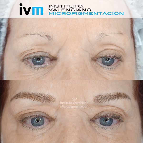 MICROPIGMENTACION-CEJAS-IVM