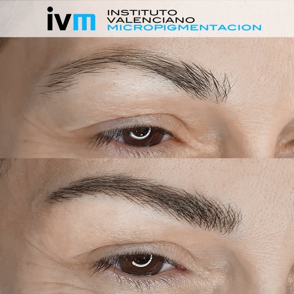 MICROPIGMENTACION-CEJAS-IVM