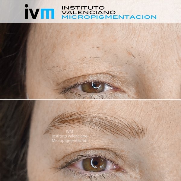 MICROPIGMENTACION-CEJAS-IVM