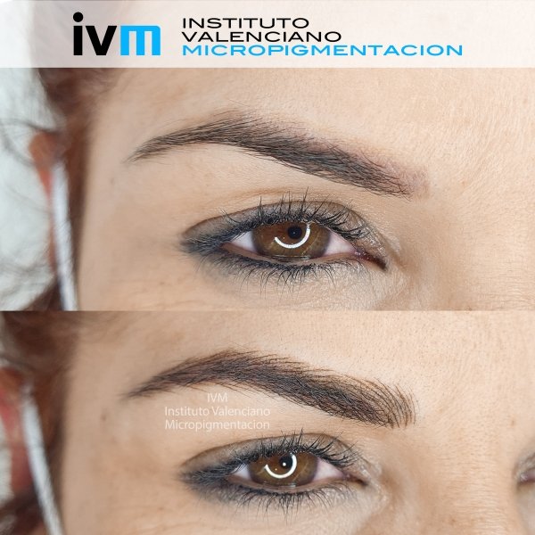 MICROPIGMENTACION-CEJAS-IVM