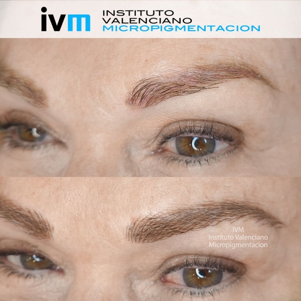 MICROPIGMENTACION-CEJAS-IVM