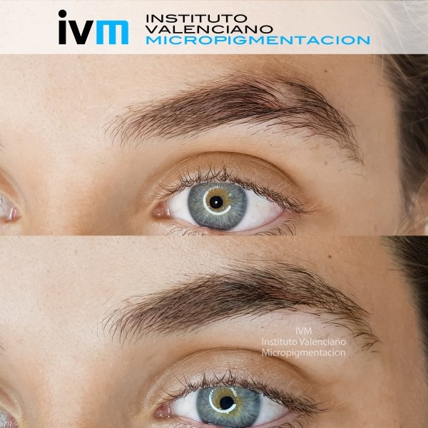 MICROPIGMENTACION-CEJAS-IVM