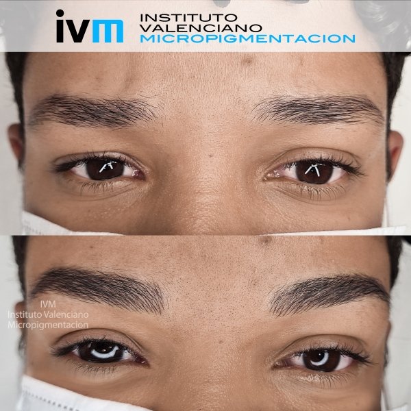 MICROPIGMENTACION-CEJAS-IVM