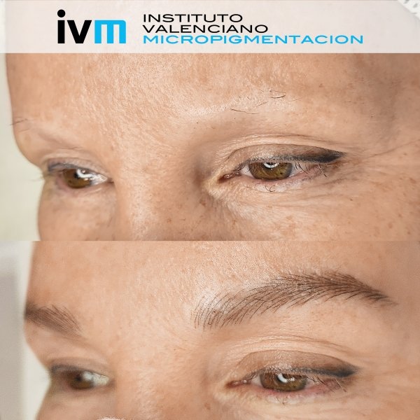 MICROPIGMENTACION-CEJAS-IVM