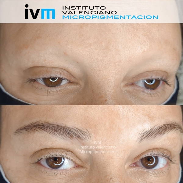 MICROPIGMENTACION-CEJAS-IVM