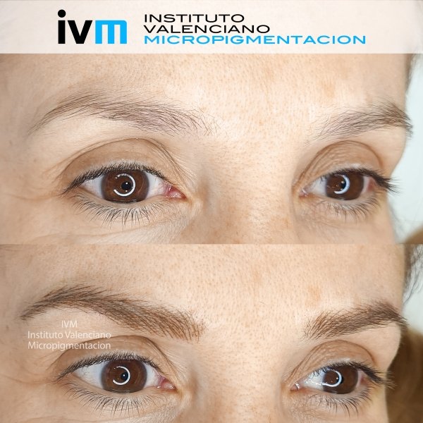 MICROPIGMENTACION-CEJAS-IVM