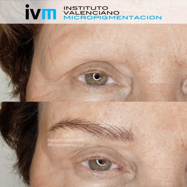 MICROPIGMENTACION-CEJAS-IVM