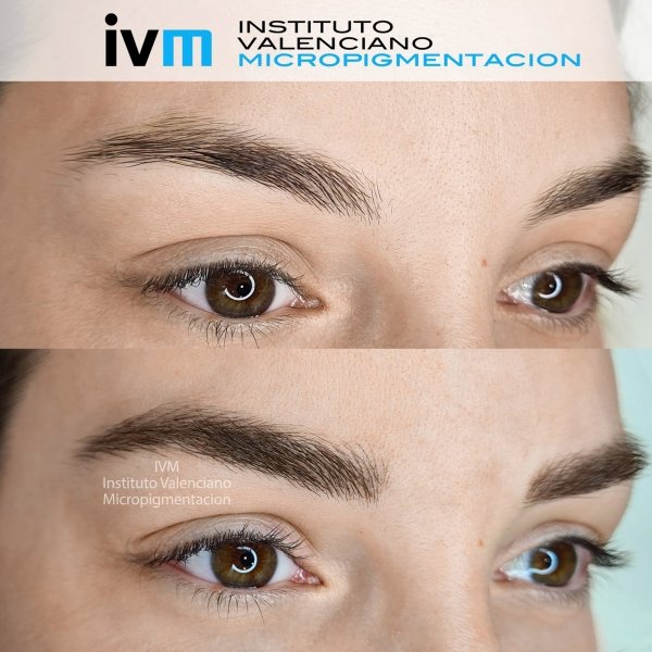 MICROPIGMENTACION-CEJAS-IVM