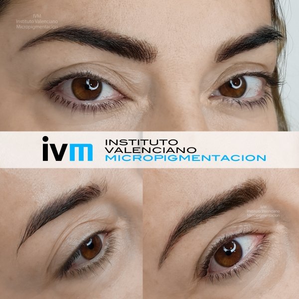 MICROPIGMENTACION-CEJAS-IVM