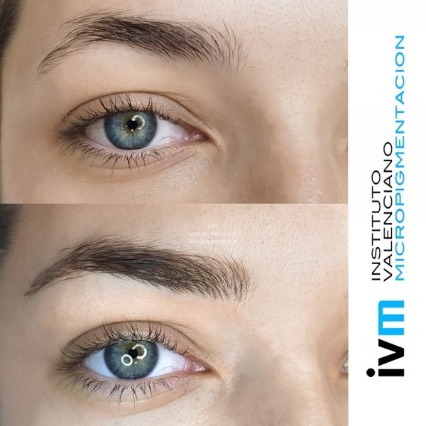 MICROPIGMENTACION-CEJAS-IVM