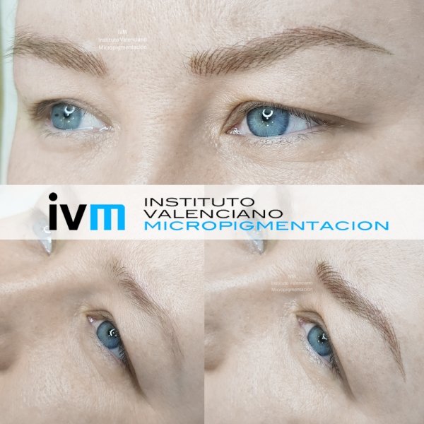 MICROPIGMENTACION-CEJAS-IVM