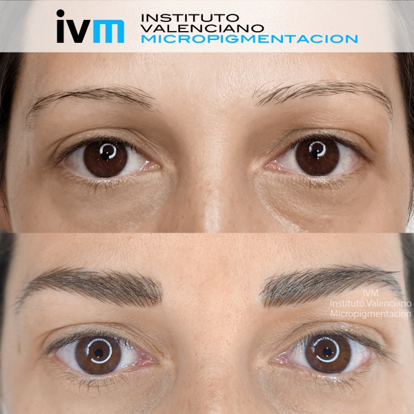 MICROPIGMENTACION-CEJAS-IVM