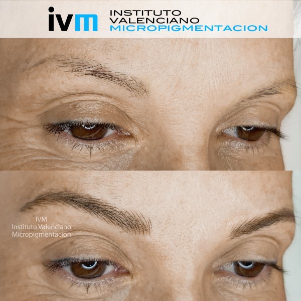 MICROPIGMENTACION-CEJAS-IVM