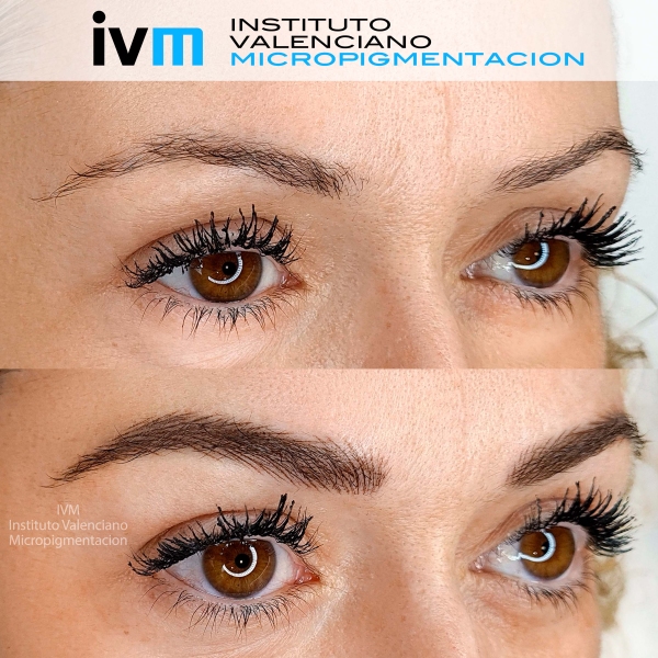 MICROPIGMENTACION-CEJAS-IVM