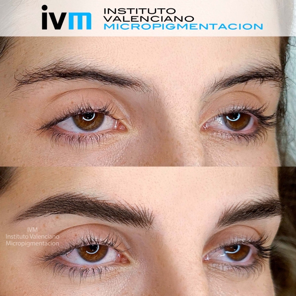 MICROPIGMENTACION-CEJAS-IVM