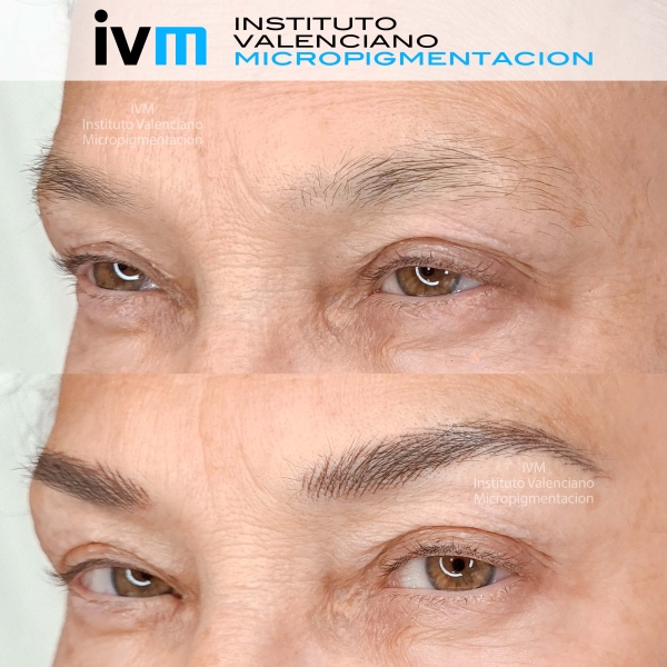 MICROPIGMENTACION-CEJAS-IVM