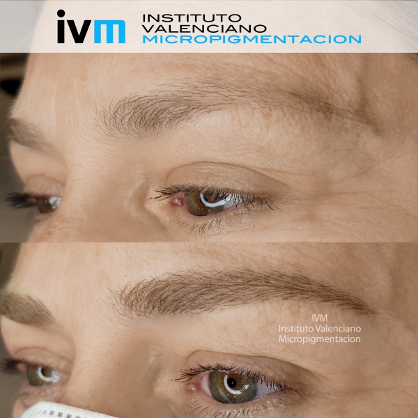 MICROPIGMENTACION-CEJAS-IVM