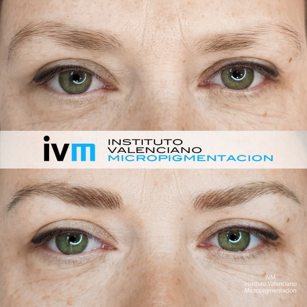 MICROPIGMENTACION-CEJAS-IVM