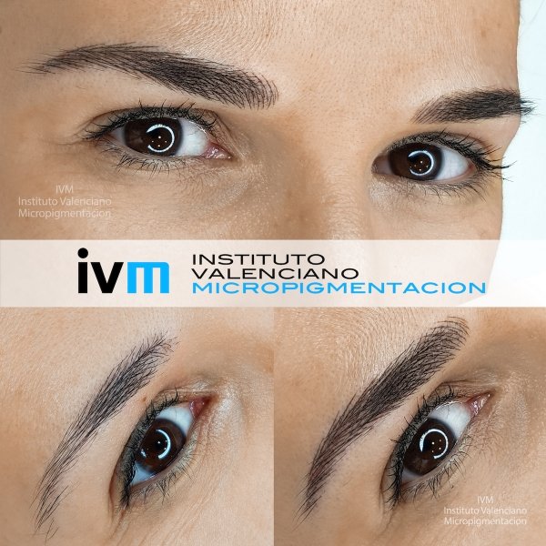 MICROPIGMENTACION-CEJAS-IVM