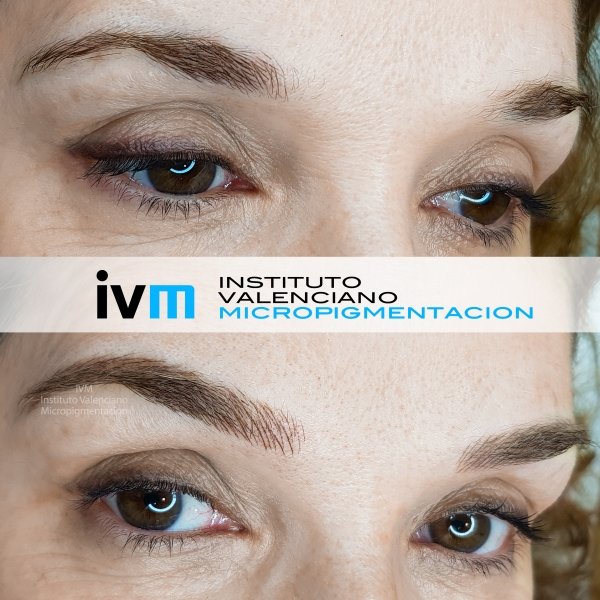 MICROPIGMENTACION-CEJAS-IVM