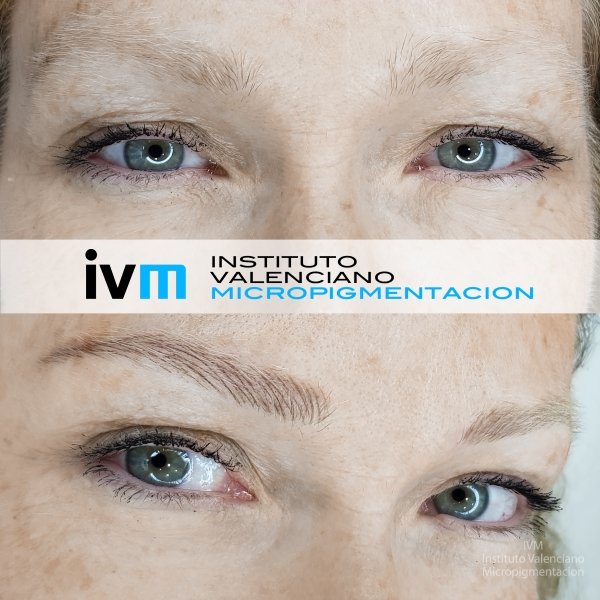 MICROPIGMENTACION-CEJAS-IVM