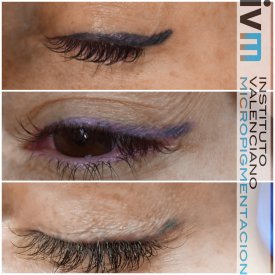 ELIMINACION_IVM