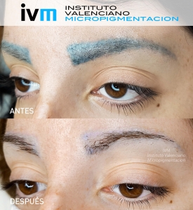 ELIMINACION_IVM