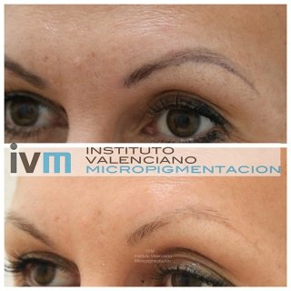 ELIMINACION_IVM