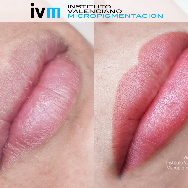 MICROPIGMENTACION_LABIOS_IVM