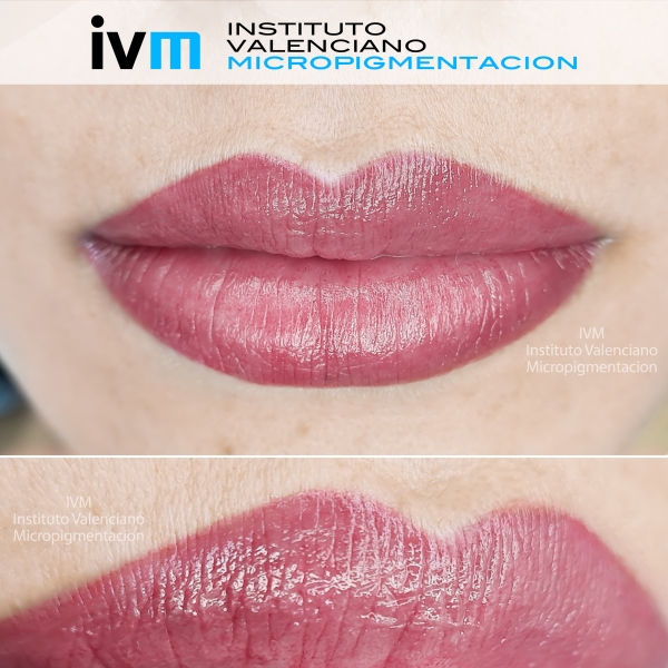 MICROPIGMENTACION_LABIOS_IVM