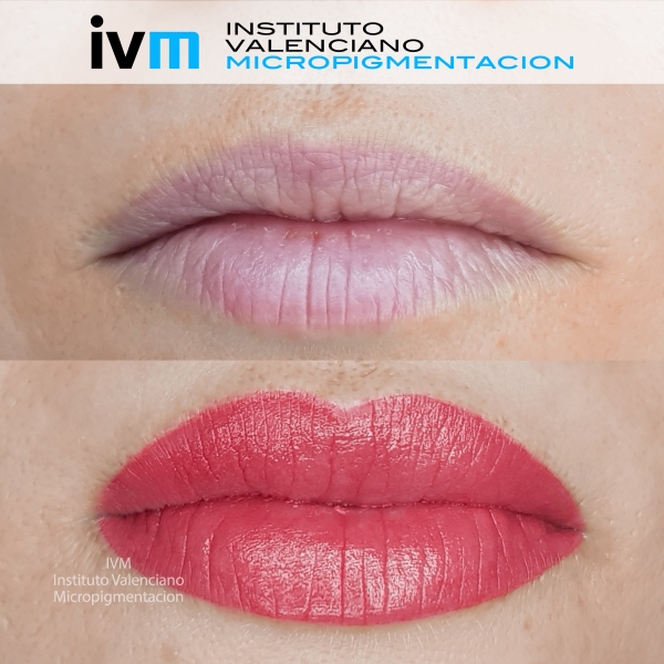 MICROPIGMENTACION_LABIOS_IVM