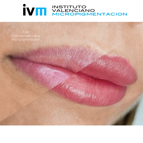 MICROPIGMENTACION_LABIOS_IVM