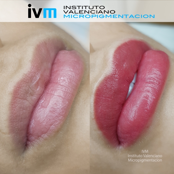 MICROPIGMENTACION_LABIOS_IVM