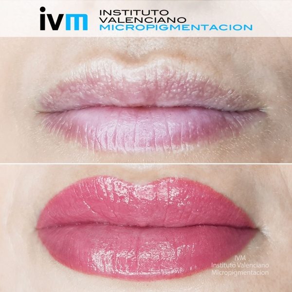 MICROPIGMENTACION_LABIOS_IVM